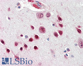 Anti-NOVA1 Antibody (Internal) IHC-plus LS-B3259