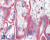 Anti-TGFBR1 / ALK5 Antibody (aa158-179) IHC-plus LS-B3261