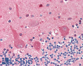 Anti-NQO1 Antibody (clone A180) IHC-plus LS-B3275