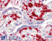 Anti-F13A1 / Factor XIIIa Antibody IHC-plus LS-B3277
