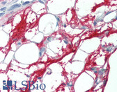 Anti-CTGF Antibody (C-Terminus) IHC-plus LS-B3284