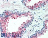 Anti-SLC45A3 / Prostein Antibody IHC-plus LS-B3288