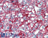 Anti-CD44 Antibody IHC-plus LS-B3289