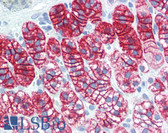 Anti-BAD Antibody (N-Terminus, clone BYC001) IHC-plus LS-B3293