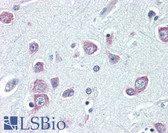 Anti-NIP3 / BNIP3 Antibody (aa112-124) IHC-plus LS-B3305