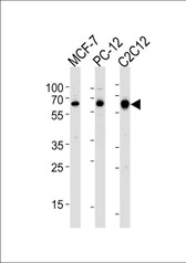 Anti-SRC Antibody (N-Terminus) IHC-plus LS-B3308