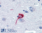 Anti-SST / Somatostatin Antibody IHC-plus LS-B3309