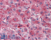 Anti-CTSB / Cathepsin B Antibody IHC-plus LS-B3313