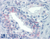 Anti-FASLG / Fas Ligand Antibody (N-Terminus) IHC-plus LS-B3314