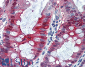 Anti-SOCS3 Antibody (clone SO1) IHC-plus LS-B3317