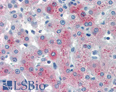 Anti-GC / Vitamin D-Binding Protein Antibody IHC-plus LS-B3318