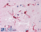 Anti-ARHGDIB / D4 GDI Antibody IHC-plus LS-B3322