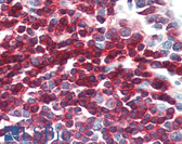 Anti-CD79A Antibody (N-Terminus) IHC-plus LS-B3324