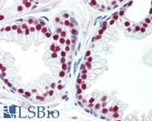 Anti-AR / Androgen Receptor Antibody (N-Terminus) IHC-plus LS-B3326