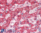 Anti-CTSD / Cathepsin D Antibody IHC-plus LS-B3327