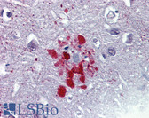 Anti-Ubiquitin Antibody IHC-plus LS-B3328