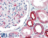 Anti-GRM1 / MGLUR1 Antibody (C-Terminus) IHC-plus LS-B3329