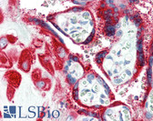 Anti-PSCA Antibody IHC-plus LS-B3332