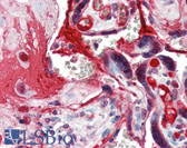 Anti-CCNE1 / Cyclin E1 Antibody (C-Terminus) IHC-plus LS-B3337