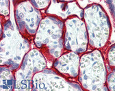 Anti-SDC1 / Syndecan 1 / CD138 Antibody (aa18-218) IHC-plus LS-B3341