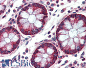 Anti-CSE1L Antibody (N-Terminus) IHC-plus LS-B3346