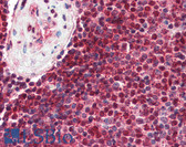 Anti-PML Antibody (aa37-51) IHC-plus LS-B3347