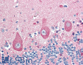 Anti-IRS1 Antibody (aa1223-1242) IHC-plus LS-B3350