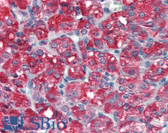 Anti-SKP2 Antibody (aa221-425) IHC-plus LS-B3361