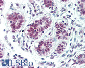 Anti-SOX4 Antibody (Internal) IHC-plus LS-B3370