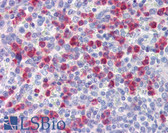 Anti-MMP9 / Gelatinase B Antibody (Internal) IHC-plus LS-B3381
