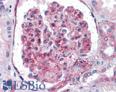 Anti-UBC / Ubiquitin C Antibody (N-Terminus) IHC-plus LS-B3386