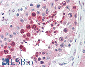 Anti-HSPA5 / GRP78 / BiP Antibody IHC-plus LS-B3388