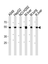 Anti-ALDH2 Antibody (N-Terminus) IHC-plus LS-B3390