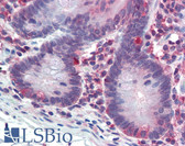 Anti-CASP1 / Caspase 1 Antibody IHC-plus LS-B3394