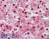 Anti-PARP1 Antibody (N-Terminus) IHC-plus LS-B3395