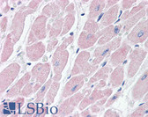 Anti-ADGRB3 Antibody (aa1506-1522) IHC-plus LS-B3397