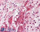 Anti-PTPRR Antibody (aa58-72) IHC-plus LS-B3400