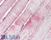 Anti-MNSOD / SOD2 Antibody IHC-plus LS-B3408