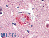 Anti-Ubiquitin Antibody IHC-plus LS-B3409