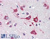 Anti-CALR / Calreticulin Antibody (clone 5F12-B10) IHC-plus LS-B3411