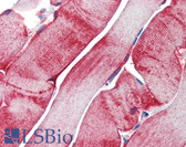Anti-HSPB1 / HSP27 Antibody (clone 5F12-B10) IHC-plus LS-B3412