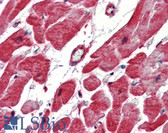Anti-HSPB1 / HSP27 Antibody IHC-plus LS-B3413