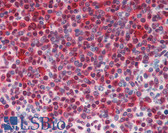 Anti-HSPA8 / HSC70 Antibody (clone 1B5) IHC-plus LS-B3415