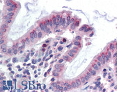 Anti-GCNT3 Antibody (Internal) IHC-plus LS-A9916