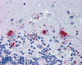 Anti-C14orf1 Antibody (Internal) IHC-plus LS-A9920