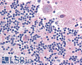 Anti-CADM2 Antibody (Internal) IHC-plus LS-A9921