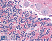 Anti-CADM2 Antibody (Internal) IHC-plus LS-A9923