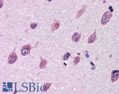 Anti-CD316 / IGSF8 Antibody (Internal) IHC-plus LS-A9934