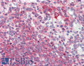 Anti-Latexin / MUM Antibody (Internal) IHC-plus LS-B3422