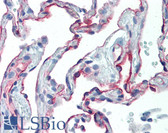 Anti-ICAM-1 / CD54 Antibody (clone 15.2) IHC-plus LS-B3431